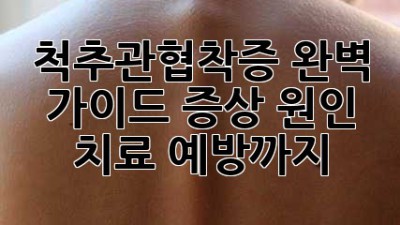 척추관협착증 완벽 가이드: 증상, 원인, 치료, 예방까지